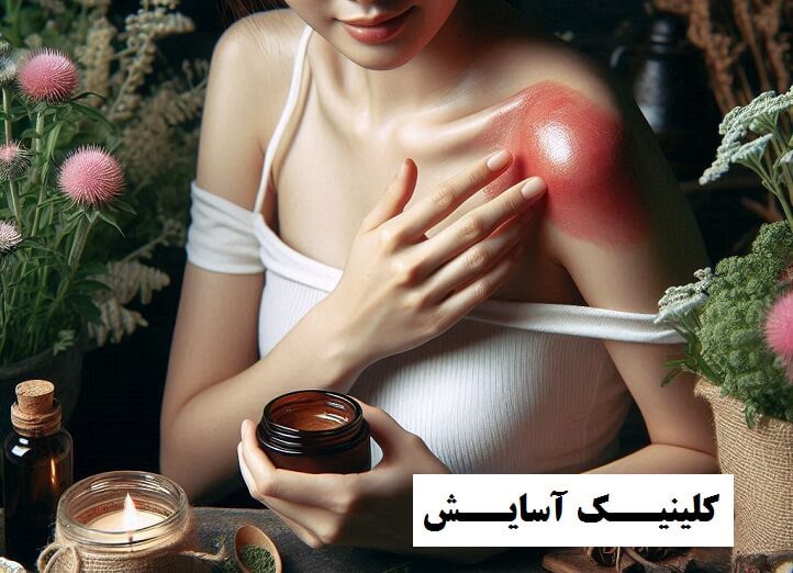 درمان گیاهی سلولیت پوست