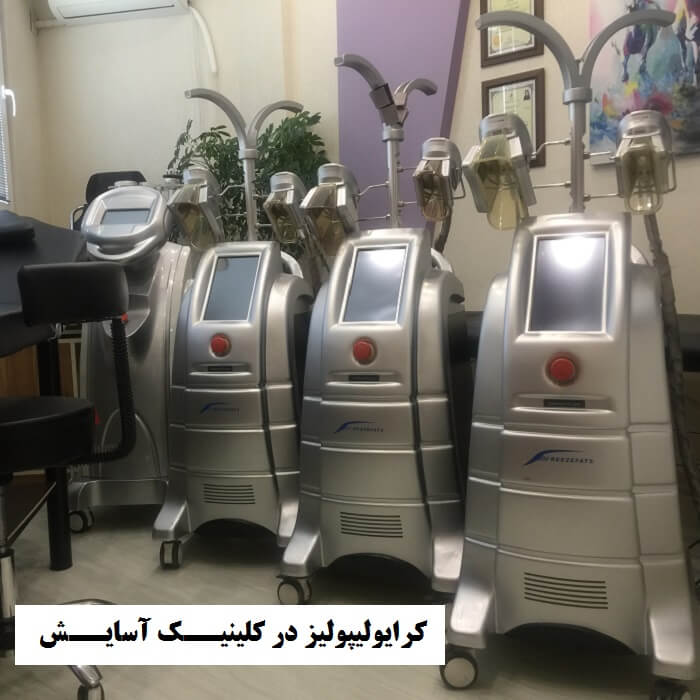 ویدیوی دستگاه و شرایط مناسب کرایولیپولیز