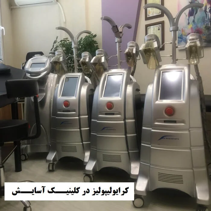 ویدیوی دستگاه و شرایط مناسب کرایولیپولیز